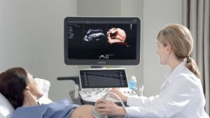 Siêu âm 5D mang đến nhiều điều bất ngờ